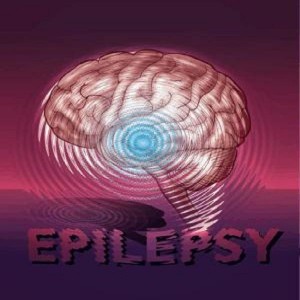 epilepsi-nedir-1