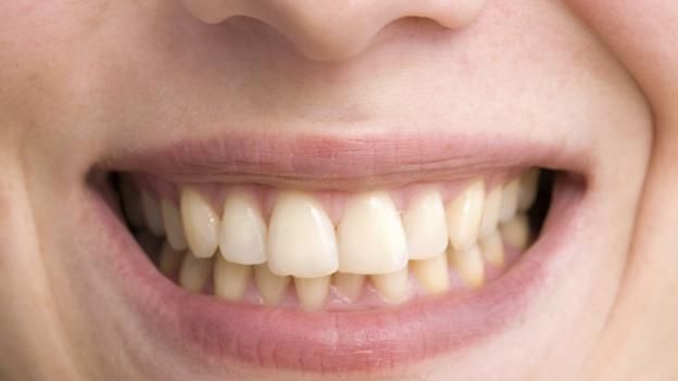 Kahve mi Yoksa Çay mı?