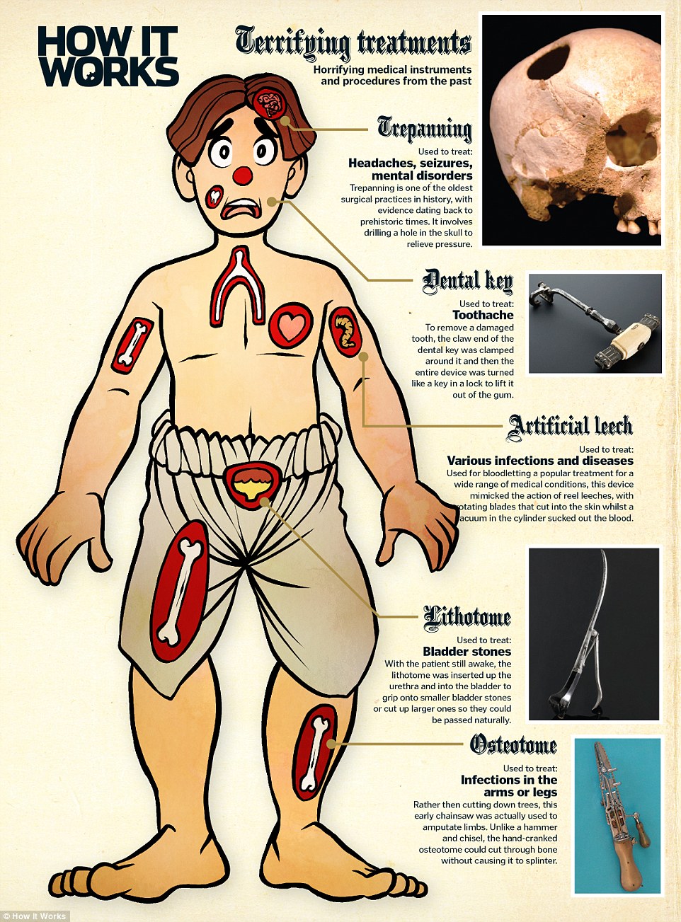 Are these the most gruesome inventions in history? Are these the most gruesome inventions in history?