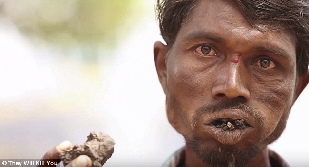Check out the top 10 scariest diseases: The 10 scariest diseases revealed, from worms burrowing into eyes to bacteria that rots the cheeks to the BONE