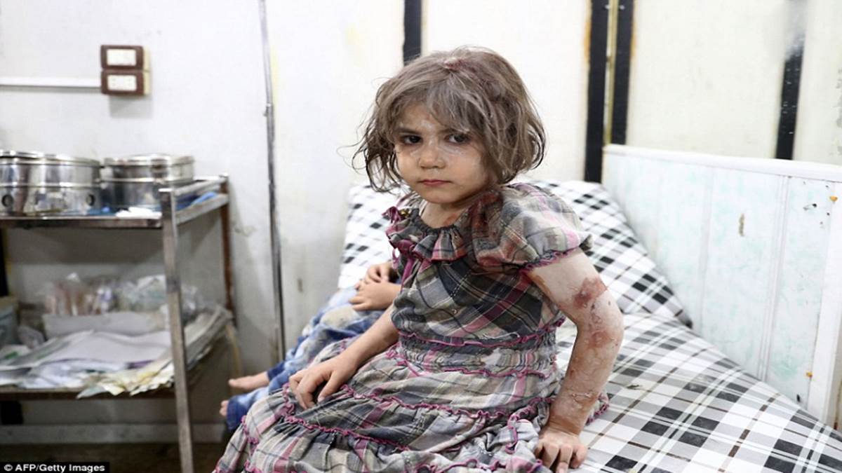 WARNING GRAPHIC CONTENT: Child victims of Syrian war