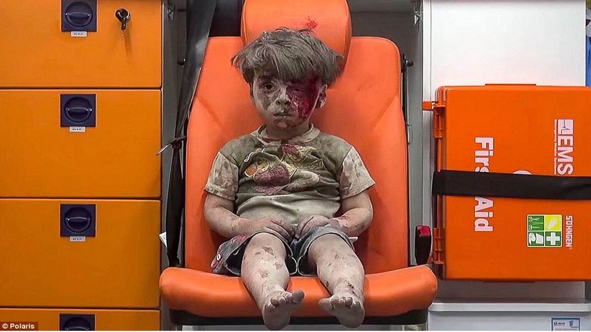 WARNING GRAPHIC CONTENT: Child victims of Syrian war