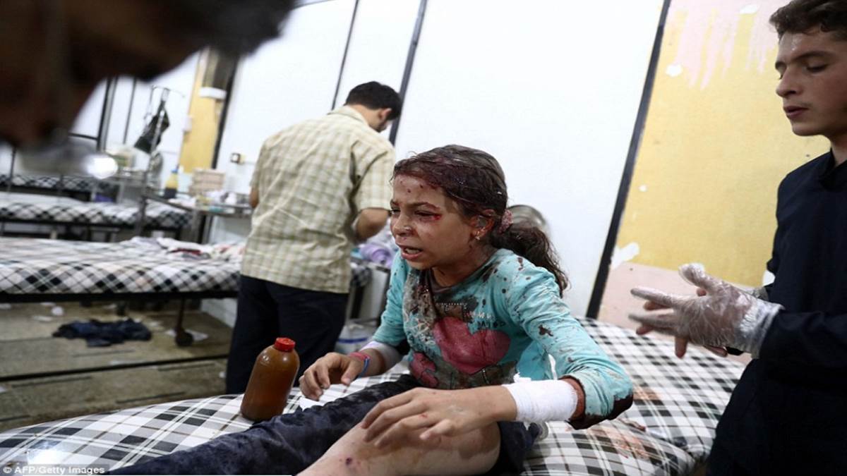 WARNING GRAPHIC CONTENT: Child victims of Syrian war