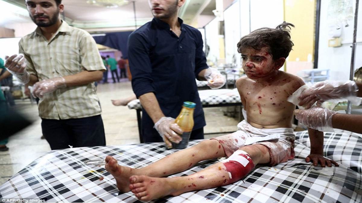 WARNING GRAPHIC CONTENT: Child victims of Syrian war