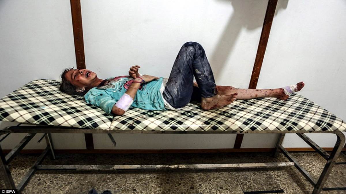 WARNING GRAPHIC CONTENT: Child victims of Syrian war