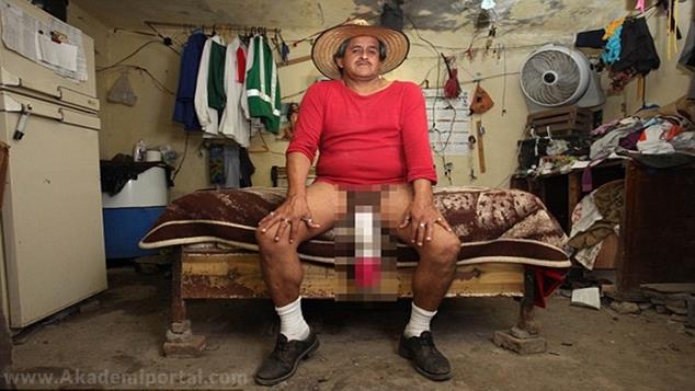 The man with the world's longest penis - Video