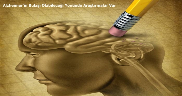 Alzheimer-akademiportal.com