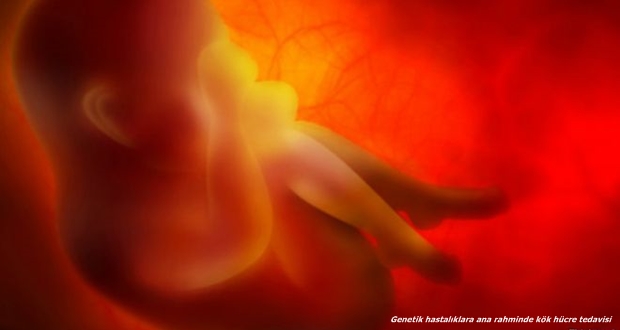 Genetik hastalıklara ana rahminde kök hücre tedavisi