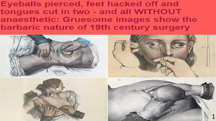 Eyeballs pierced, feet hacked off and tongues cut in two - and all WITHOUT anaesthetic: Gruesome images show the barbaric nature of 19th century surgery