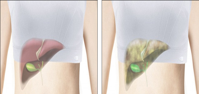 Revealed, your body on sugar Revealed, your body on sugar