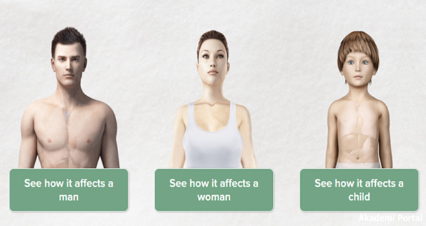 Revealed, your body on sugar