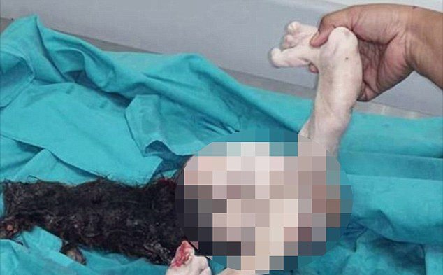 İnformation Center: WHAT IS FOETUS IN FETU?