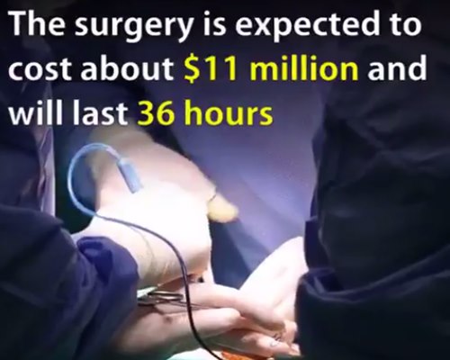 This is how the world's first head transplant will be carried out This is how the world's first head transplant will be carried out