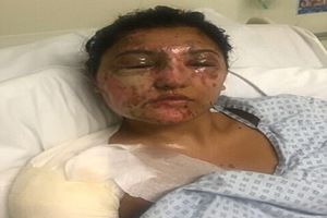 Acid attacks in Hackney: Police Treat Acid Attack Victim On Queensbridge Road, Hackney