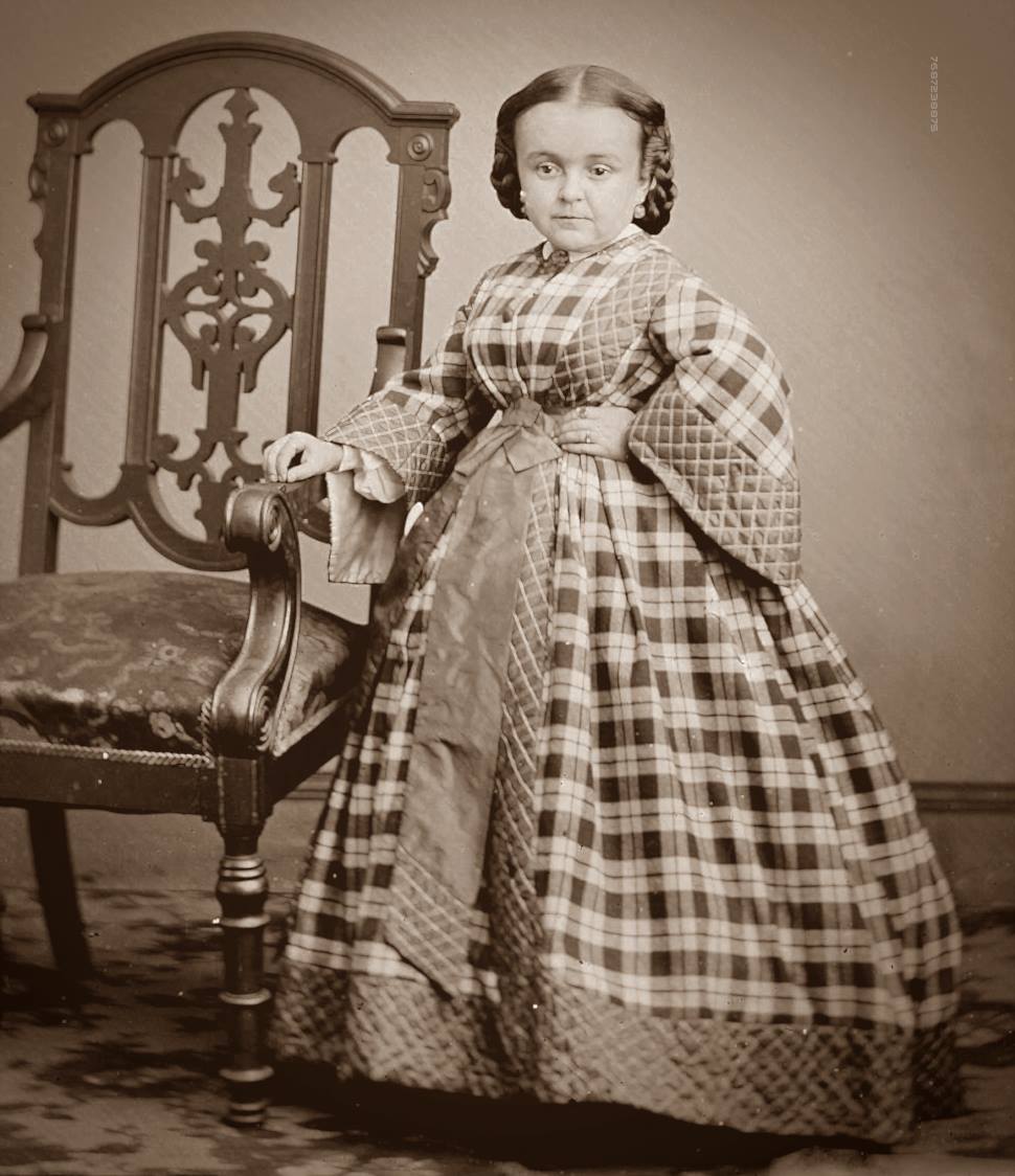 By The 1890s, Victorian 'Freak Shows'