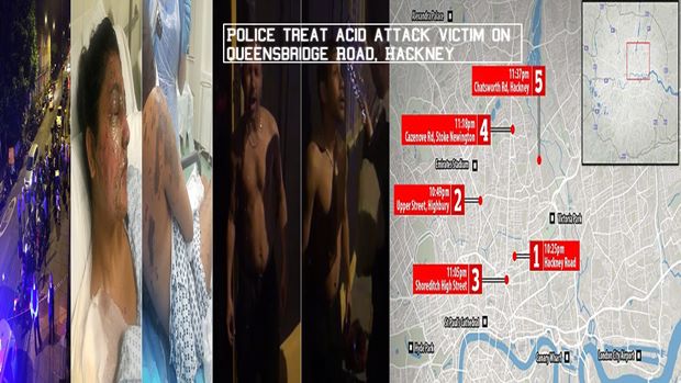 Acid attacks in Hackney: Police Treat Acid Attack Victim On Queensbridge Road, Hackney