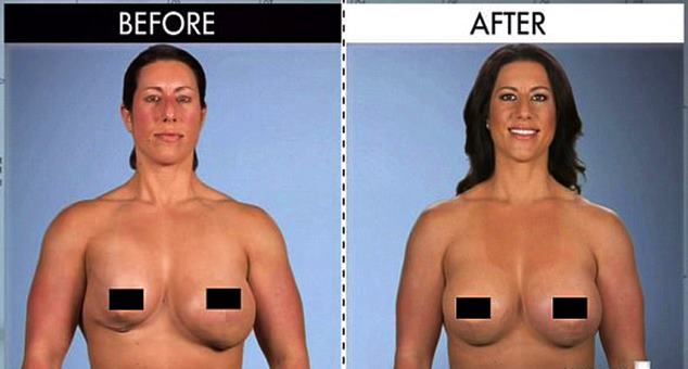 Botched: Body builder Melissa told she needs an unusual boob job