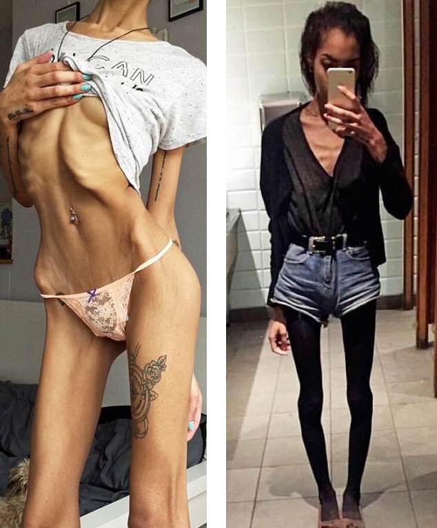 Five-stone anorexic mum transforms to incredible gym bunny Video