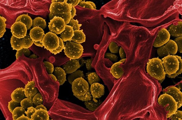 Sağlık Köşesi: Saç Dökülmesine Neden Olan Unsurlar