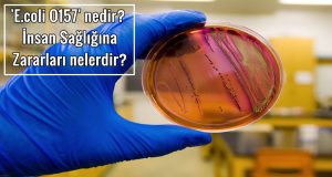'E.coli O157' nedir? İnsan Sağlığına Zararları nelerdir?