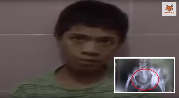 Indonesian boy claims laid 20 eggs (Video news) Indonesian boy claims laid 20 eggs (Video news)