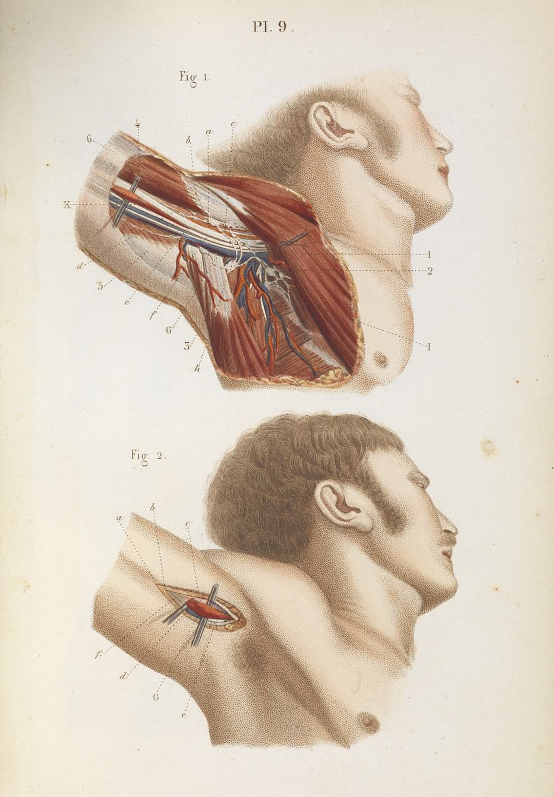 Gruesome images show the barbaric nature of 19th century surgery