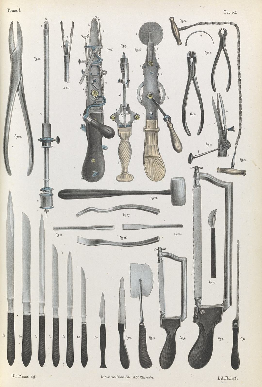Gruesome images show the barbaric nature of 19th century surgery