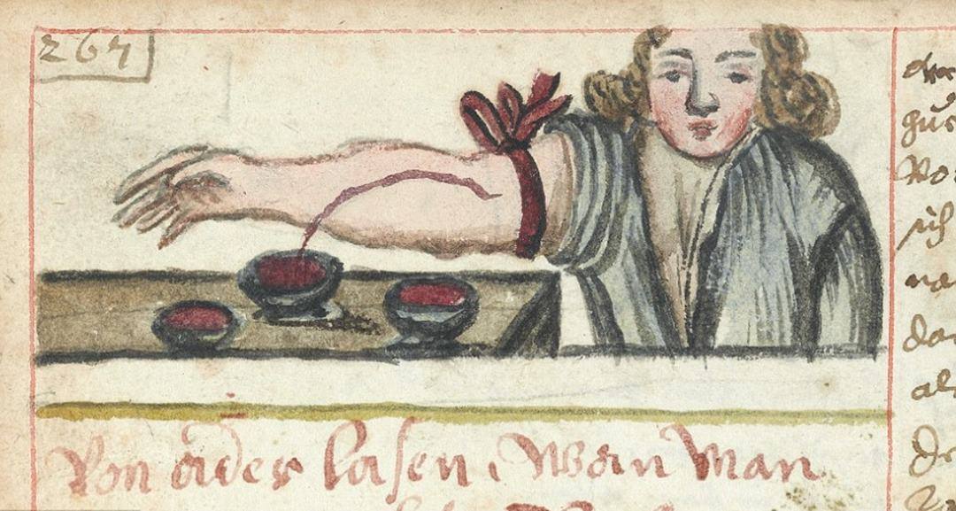 Gruesome images show the barbaric nature of 19th century surgery