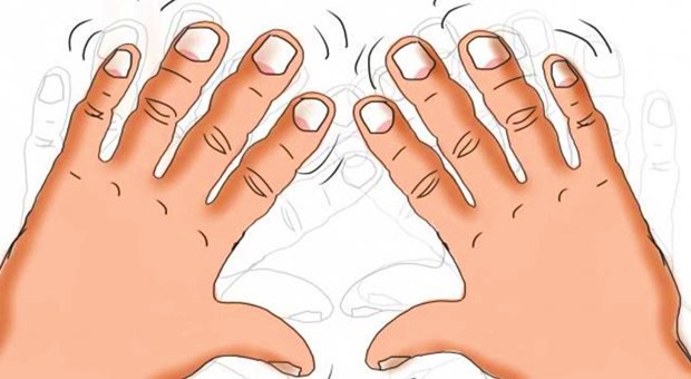 Oksipital nevralji: Oksipital ağrının nedeni nedir?