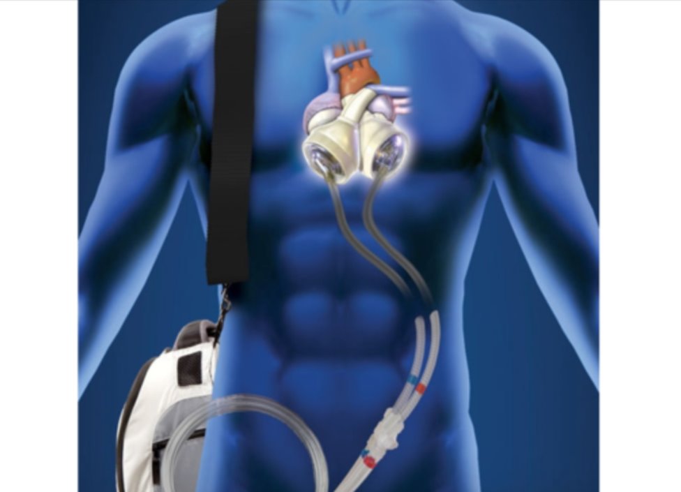 Dr. Dilek Gürsoy Yapay Kalpte Çığır Açmak İçin Çalışıyor