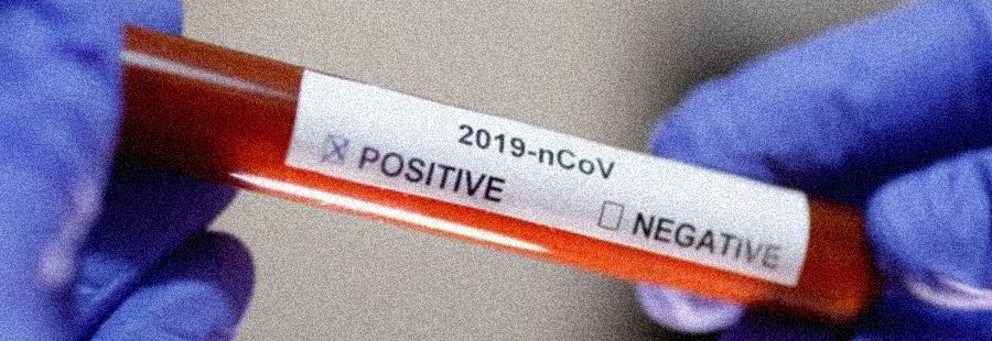 Koronavirüs salgını ne zaman bitecek?