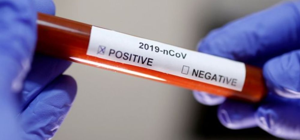 Koronavirüs: Koronavirüs rehberi Bilmeniz gerekenler sayfada