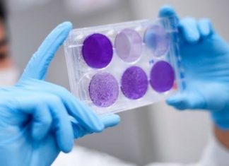 Koronavirüs vaka sayısında dünya genelinde rekor artış