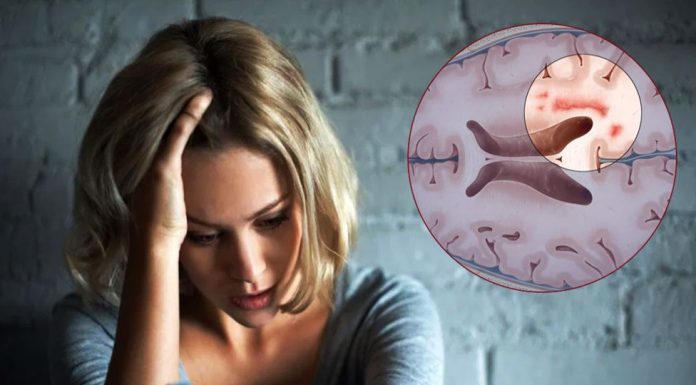 Beyin sisi: Koronavirüs geçiren her 10 hastanın birinde görülüyor