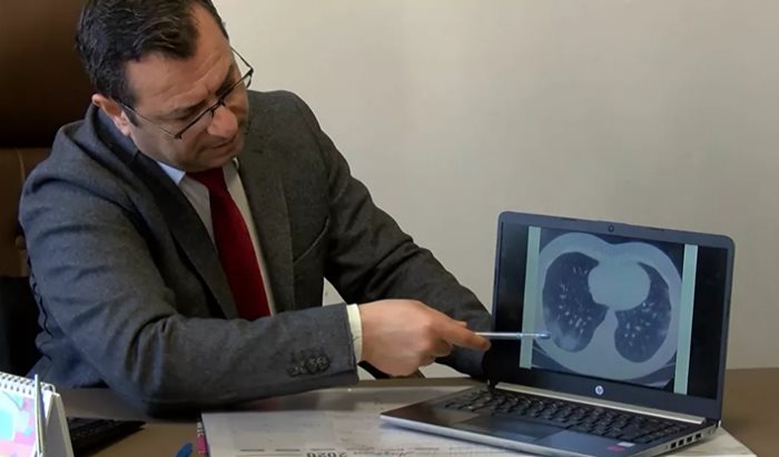 Prof. Dr. Karadaş: Koronavirüs baş ağrısı normal baş ağrısından farklı