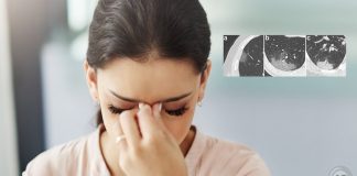 Prof. Dr. Karadaş: Koronavirüs baş ağrısı normal baş ağrısından farklı