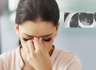 Prof. Dr. Karadaş: Koronavirüs baş ağrısı normal baş ağrısından farklı