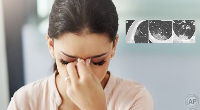 Prof. Dr. Karadaş: Koronavirüs baş ağrısı normal baş ağrısından farklı