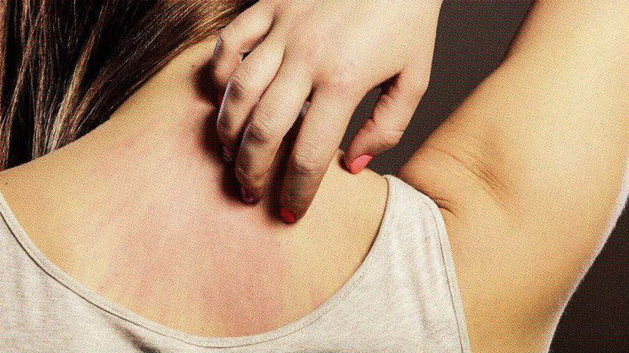 Uyuz vakalarında son zamanlarda artışın kaynağı ve sebebi nedir?