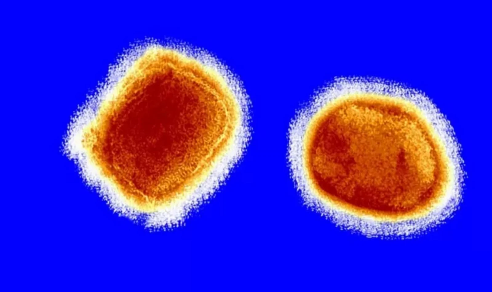 Dünya Sağlık Örgütü (WHO), maymun çiçeği virüsünü "küresel sağlık acil durumu" ilan etti