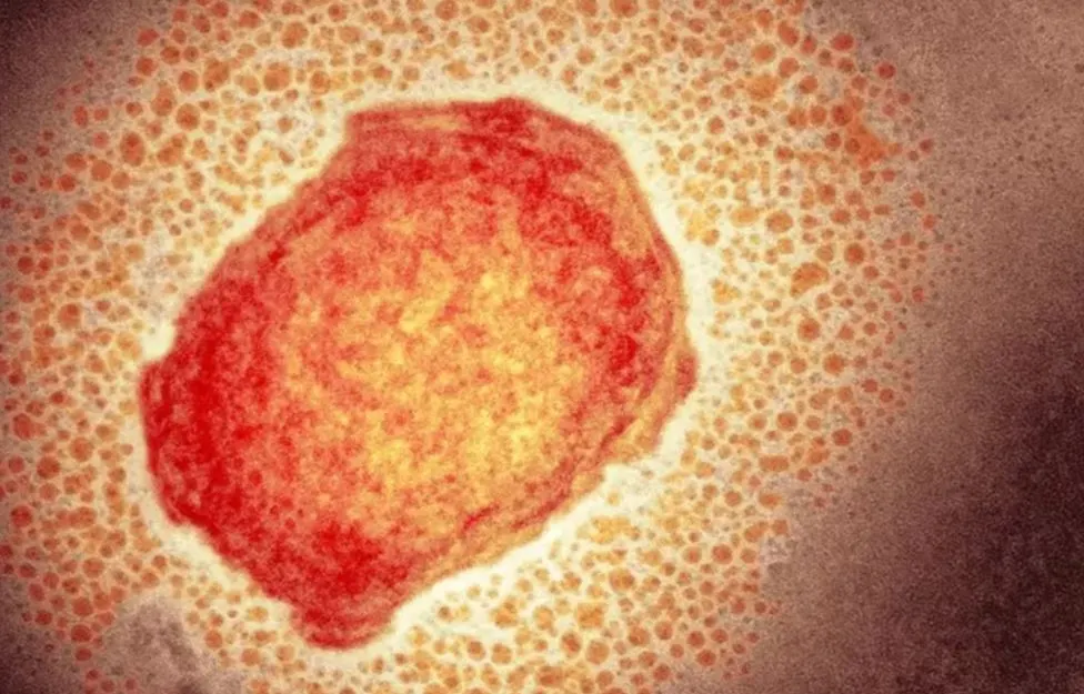 Maymun çiçeği virüsünün görüldüğü ülkelerin sayısı artıyor Hastalık nasıl bulaşıyor