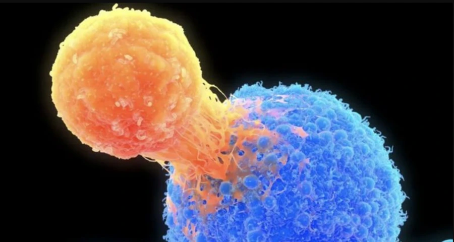 Bilim insanları deneysel bir araştırmada 'kişiye özel kanser tedavisi' üzerine çalışıyor