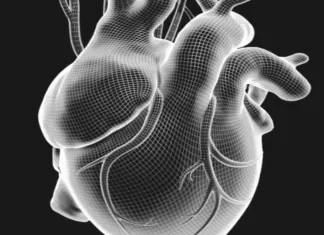 Atriyal fibrilasyon hakkında: belirtiler, nedenler ve tanı